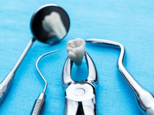 Удаление зубов